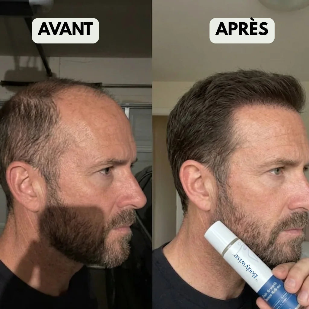 Roll-On Repousse Naturelle